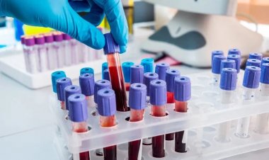 Sesau amplia coleta de exames laboratoriais com descentralização de atendimento