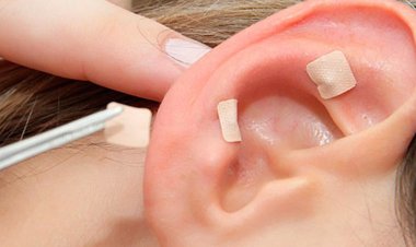 Sesau promove curso de formação em auriculoterapia