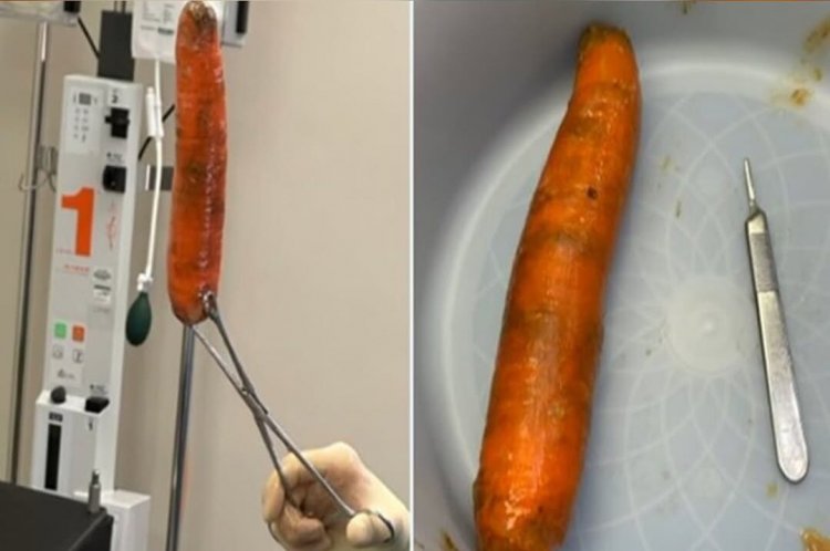 Homem enfia cenoura de 20 cm no ânus e é hospitalizado com urgência; confira