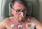 Equipe médica retirou os drenos abdominais de Bolsonaro; estado de saúde é revelado