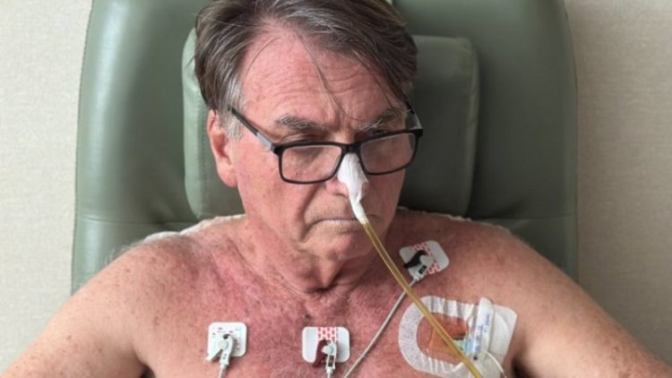 Equipe médica retirou os drenos abdominais de Bolsonaro; estado de saúde é revelado